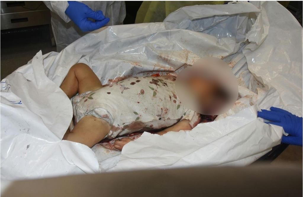 Hamas is killing babies! 
#HamasISIS