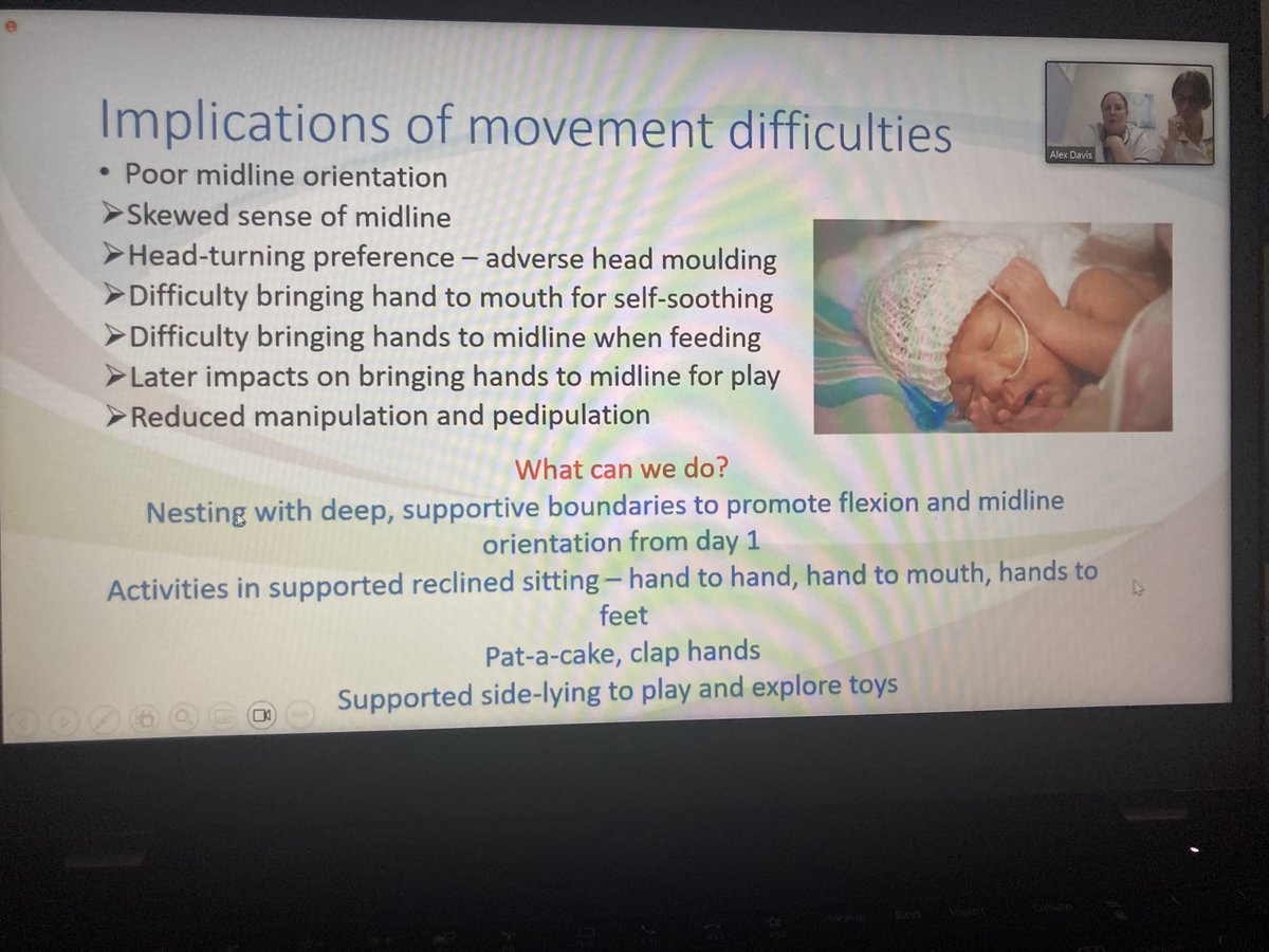 Long term outcomes are so strongly related to the support we offer early on. Very pleased to see this so clearly described. Positioning, posture, tone, self feeding ability, swallow! All can be affected if we don’t manage it early #neonatalfeeding #HotTopics2023