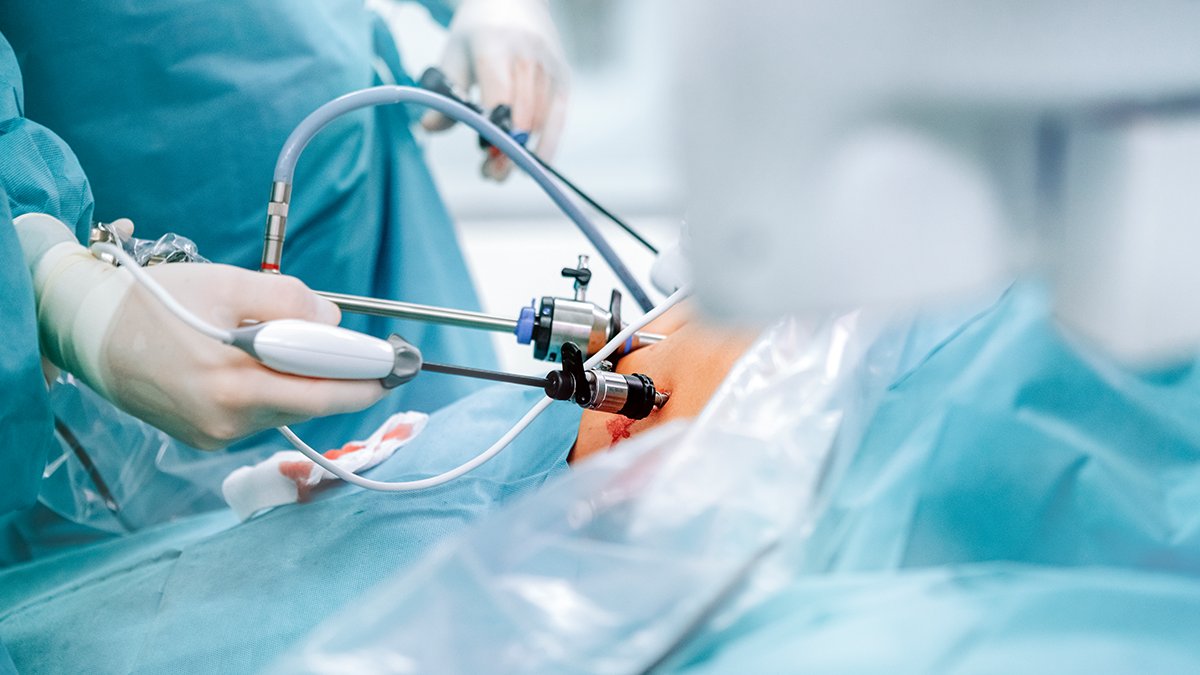 The Royal College of Surgeons of England (@rcsnews) on Twitter photo Unlock the secrets to mastering laparoscopic surgery with our latest #Bulletin feature article from <a href="/ElBoghdadyMike/">Michael El Boghdady</a>.
Offering twelve invaluable tips that could transform your career, this is one you won't want to miss.
Read the full article today: ow.ly/oC0Q50PUXFC Unlock the secrets to mastering laparoscopic surgery with our latest #Bulletin feature article from <a href="/ElBoghdadyMike/">Michael El Boghdady</a>.
Offering twelve invaluable tips that could transform your career, this is one you won't want to miss.
Read the full article today: ow.ly/oC0Q50PUXFC