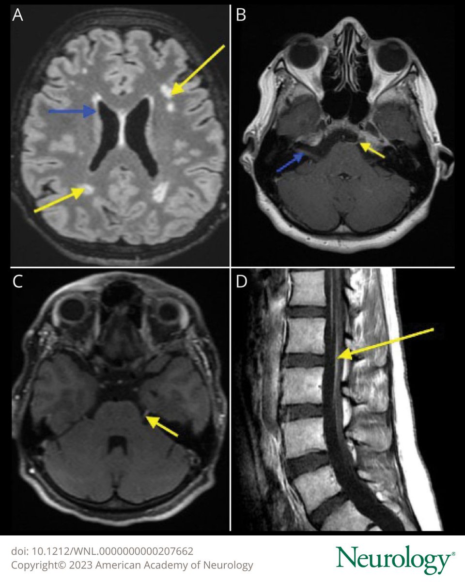 Neurology Journal tweet media