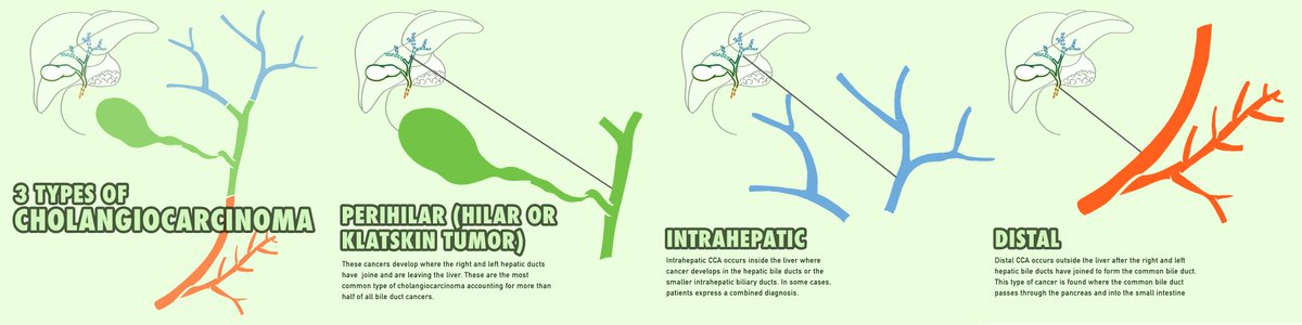 curecc's tweet photo. October is Liver Cancer Awareness Month! Did you know there are 3️⃣ types of #cholangiocarcinoma?

Staging is a way to describe how far the tumor has spread and to decide which treatment might be the most appropriate. 

Learn more at https://t.co/HHyIxuCF2X. #Octoberis4Livers https://t.co/VLpZoqputQ