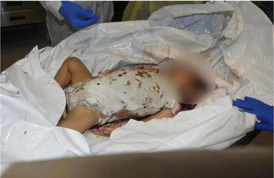 With a heavy heart, I post this. Here is the proof the world has been asking for — a murdered baby.