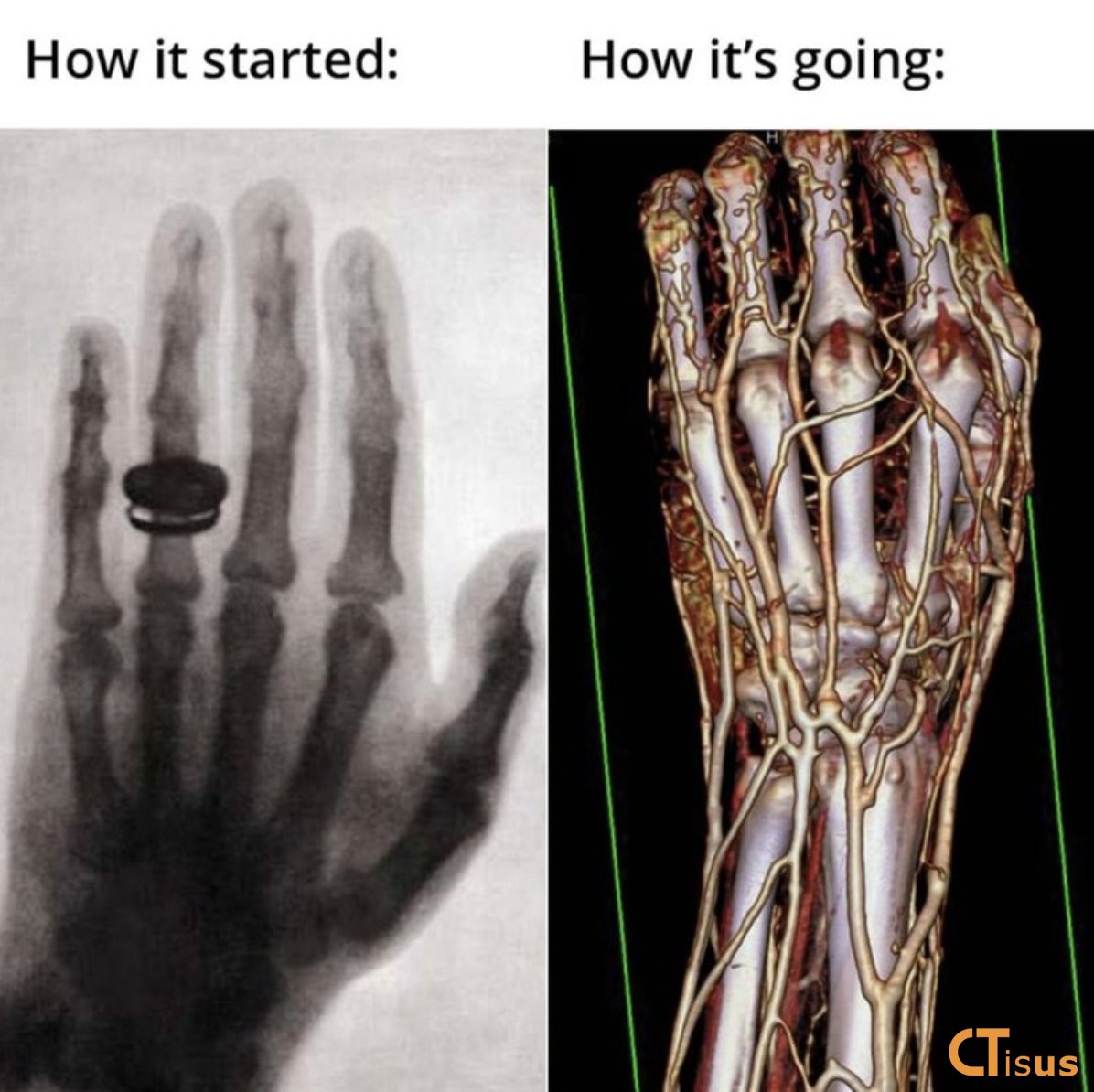 Happy International Day of Radiology