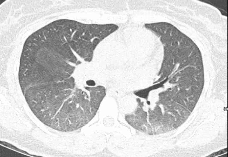 UTSWRheum tweet media