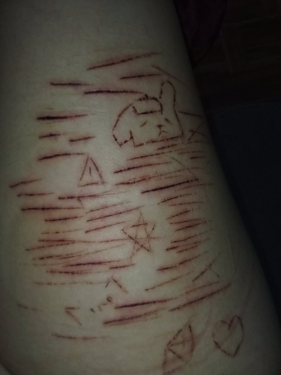 kittycuting's tweet photo. cicatrizandouuu🦈 https://t.co/xohSHfmh1X