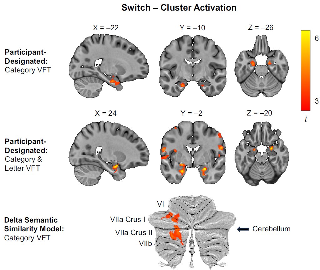 JoshBrownNeuro's tweet photo. How does human memory search work? The hippocampus and cerebellum are key for cognitive foraging. New paper w/ @NancyBLundin, @swazi65, more https://t.co/WgI3IvvWge https://t.co/v8vxIrarxv