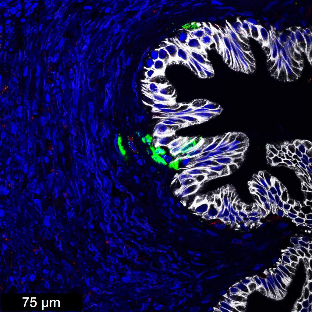 NinaSteele17's tweet photo. Why I often use @ACDbio …. 🤷🏻‍♀️
CXCL10 RNA ✅ PANCK protein ☑️ CD68 RNA ♦️pancreas FFPE. Imaged on @LeicaCameraUSA #STELLARIS https://t.co/VhRB9lO4Ky