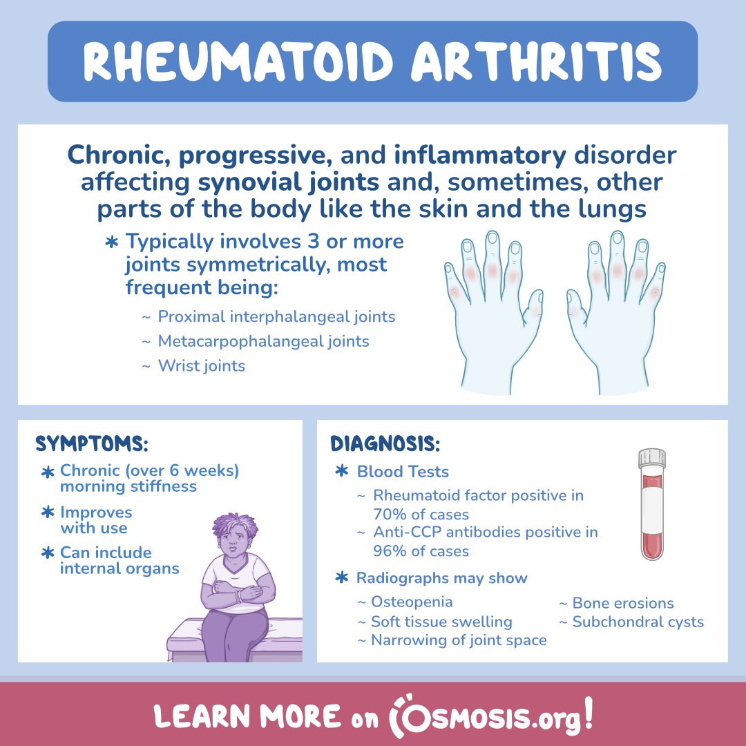 We're raising awareness for #WorldArthritisDay in today's #PathologyReview!

Rheumatoid arthritis is a chronic, progressive, and inflammatory disorder that primarily affects synovial joints and sometimes other parts of the body, such as lungs.

Learn more: osms.it/path-rheu-arth…