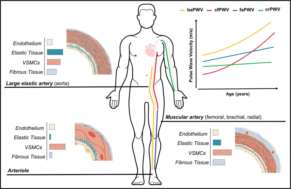 HyperAHA's tweet photo. REVIEW: Reimagining the Value of Brachial-Ankle Pulse Wave Velocity as a Biomarker of Cardiovascular Disease Risk—A Call  to Action on Behalf of VascAgeNet

https://t.co/qM4TVQ71Fg https://t.co/Rbbu2uW41p