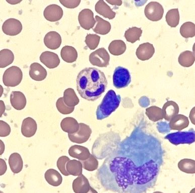 Spotted the happiest little fella down the microscope today #pathology #histopathology #haematopathology #olympus #pathologytraining <a href="/RCPath/">RC of Pathologists</a>