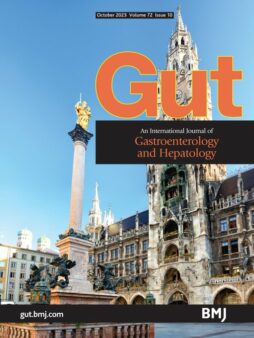 CharityAMMF's tweet image. Now published in GUT, the most comprehensive guidelines in the diagnosis &amp;amp; management of CCA, commissioned by @BritSocGastro &amp;amp; headed by Professor Shahid Khan alongside other UK experts, including #AMMF’s @HelenMorement.  ow.ly/WUGl50PVunX #livertwitter