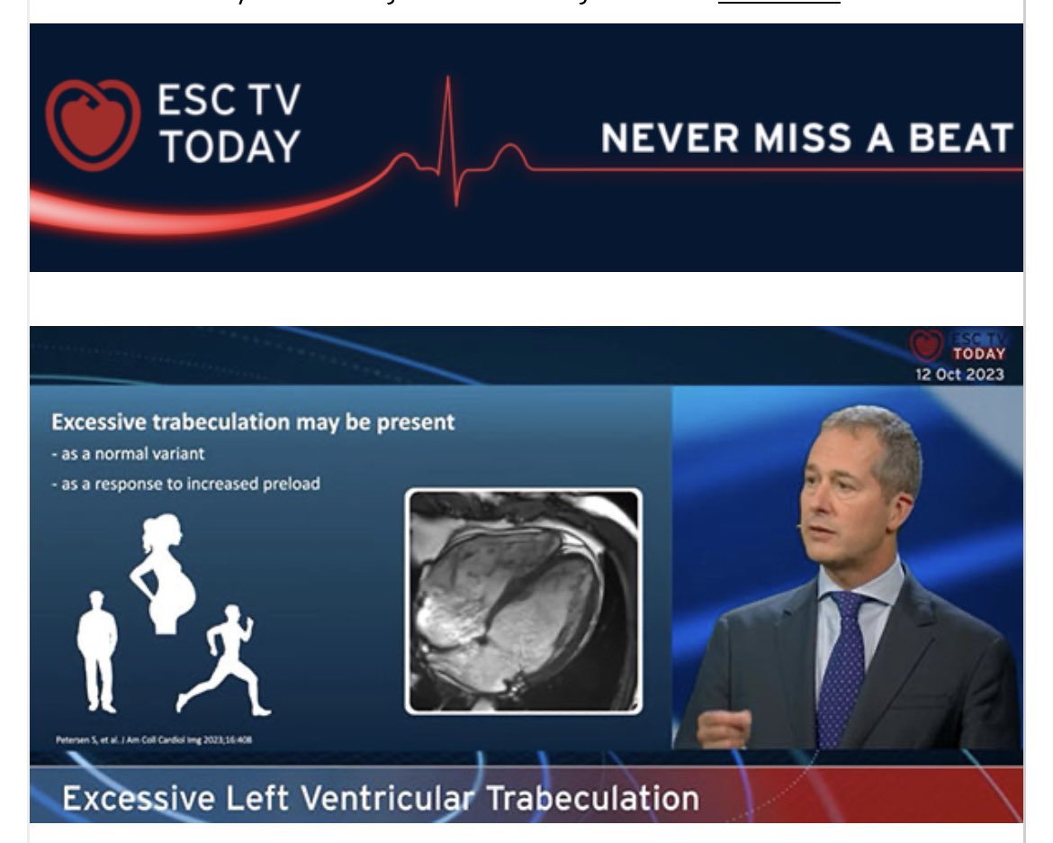 Watch just under 6 mins on so called non-compaction on #ESCTVToday eur01.safelinks.protection.outlook.com/?url=https%3A%…
@BjarkeJensen4 @NayAungMD @mgwfriedrich