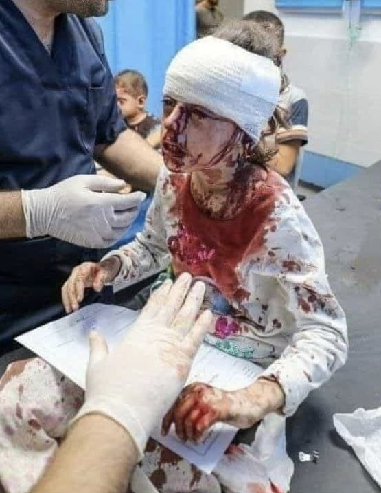 sahabatalaqsha's tweet photo. UPDATE #Gaza 

Kemenkes: Jumlah warga #Palestina yang gugur dibunuh Zionis bertambah menjadi 1417 orang, sementara 6,268 lainnya cedera sejak Perang #TaufanAlAqsha Sabtu 7/10/2023 lalu.

#GazaMenang https://t.co/E77fwNTyIP