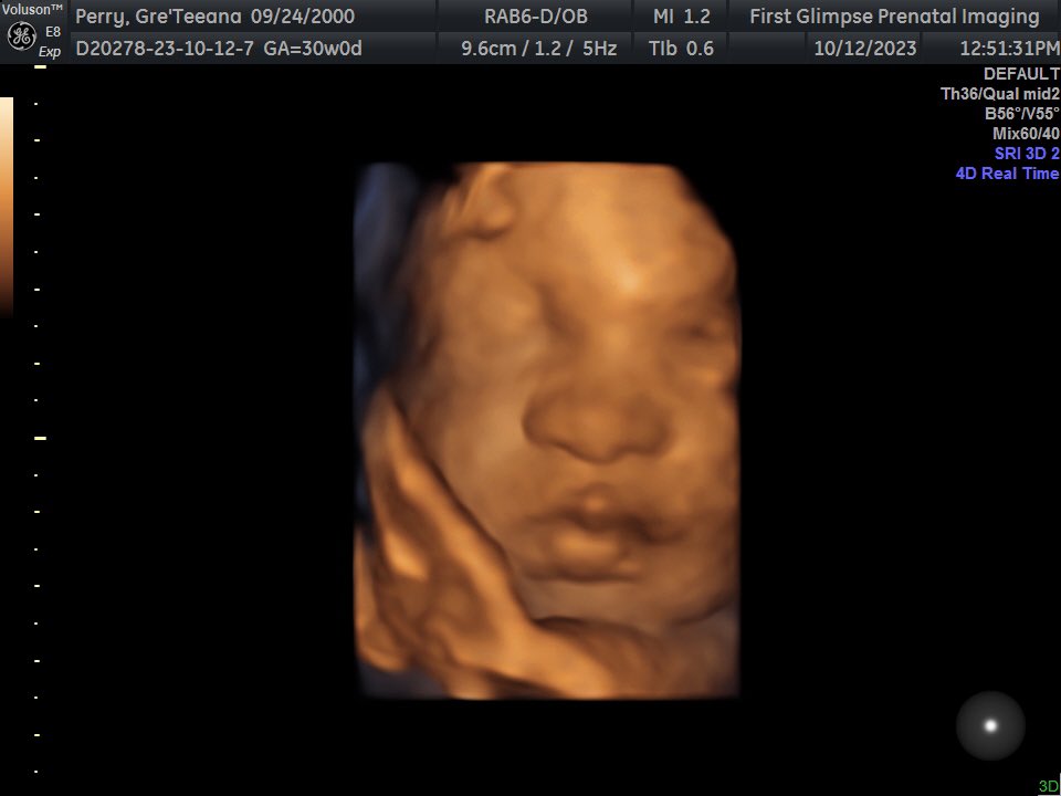 darealbg_'s tweet photo. my sweet munchkin 💗 mommy can’t wait to meet you 🥹 #10weeksleft https://t.co/uAGT8sne3i