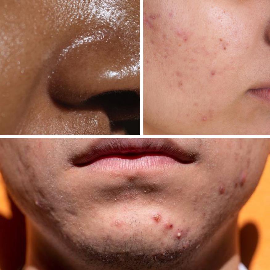 ✨REKOMENDASI SKINCARE KHUSUS COWOK 2023✨

Buat cowok yg pgn mukanya jadi mulus, bebas jerawat, dan cerah, mimin udh pilihin TOP PICKS skincare brand local 
khusus buat cowok!

A Thread