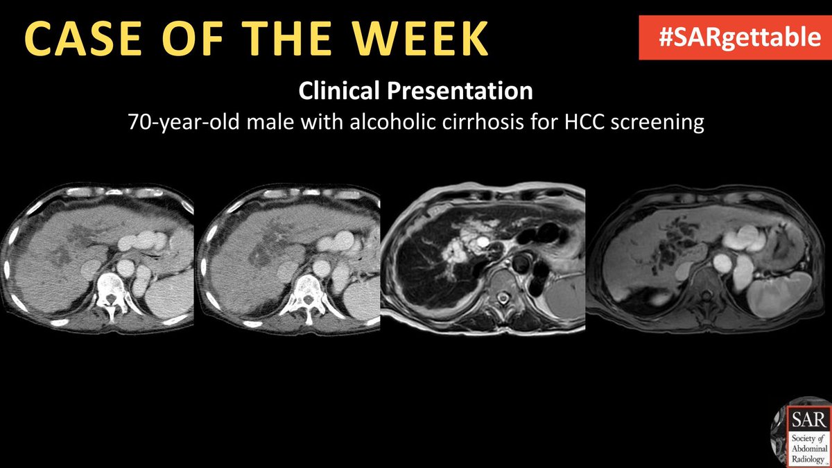 It's time for a new #SARgettable case of the week contributed by @kchang! Comment with your diagnosis down below!