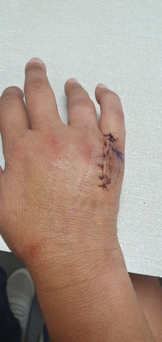 tracelex2011's tweet image. Sick of this pain now. Sick of not sleeping and feeling grumpy. Need cheering up. If u have any funny jokes or quotes send em my way so I can giggle haha