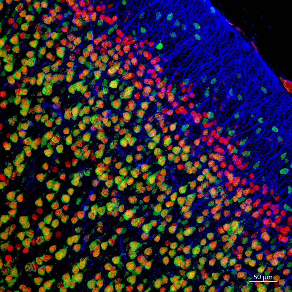 DaniBeckman's tweet image. Cortical development is in progress! Radial glia (🔵GFAP) is helping guide immature neurons (🔴SATB2) to find their final position during cortical development. Some neurons already express a mature neuronal marker (🟢NeuN) concomitantly. @zeiss_micro #neuroscience