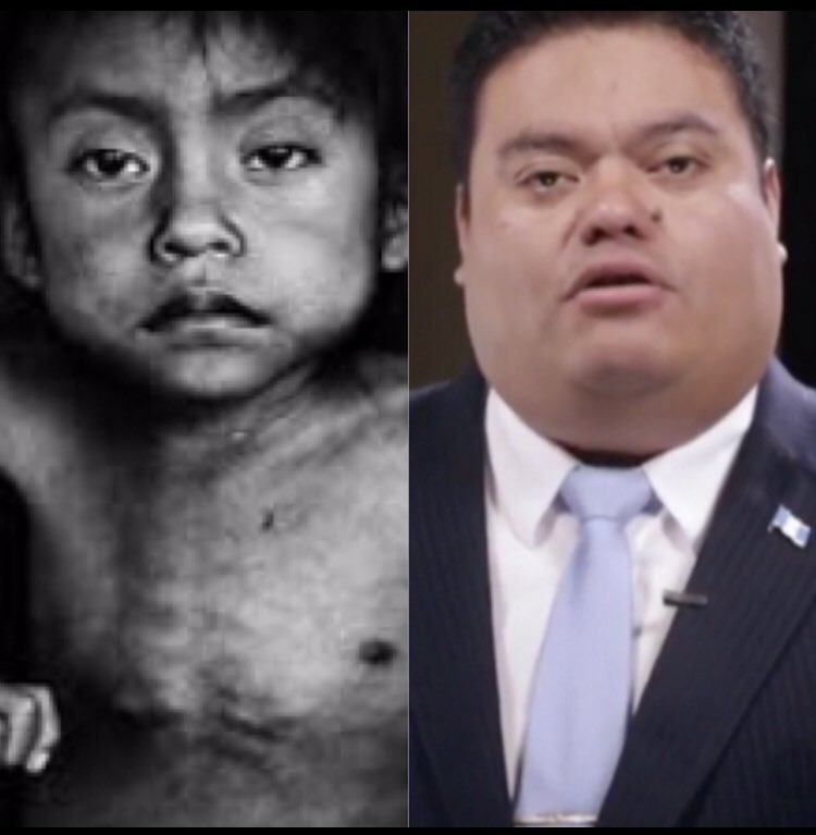 ESTO ES BLOQUEO! 
Bloqueo de la alimentación para 48% de niños que mueren de desnutrición  en todo el país mientras los corruptos se transforman en verdaderos cerdos y se vuelven millonarios con los recursos que le roban al pueblo. ¡Este bloqueo es el que tiene que cambiar!