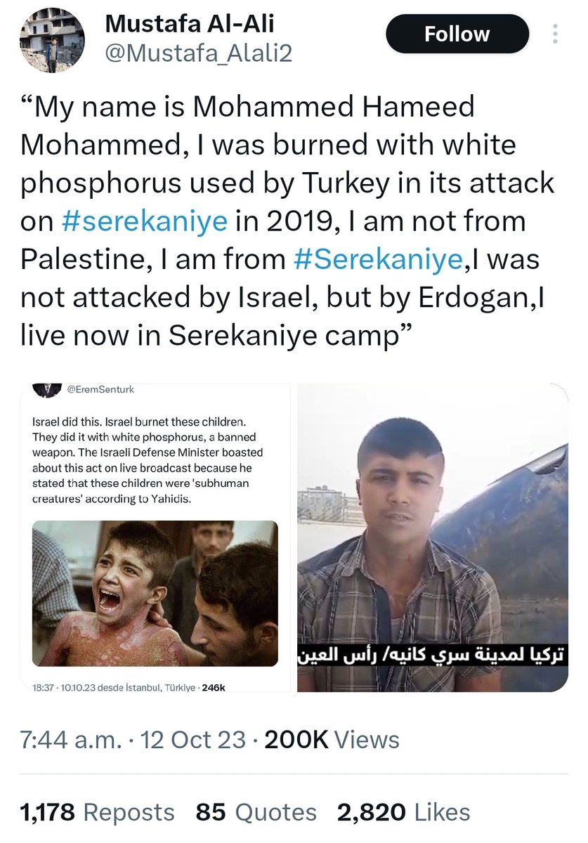 SHakkakpour's tweet photo. دیدن عکس این کودک واقعا وحشتناک و دلخراشه 😔 در کنار مردم عادی بدون سلاح هستم. 

در پست اشاره شده که این اتفاق در ۲۰۱۹ صورت گرفته. در عجبم چرا بعضی از کاربران بمباران چندروز پیش دولت ترکیه را با این عکس منتشر می‌کنند؟ 😐
#IStandwithCivilians https://t.co/bkEM3l2zd0