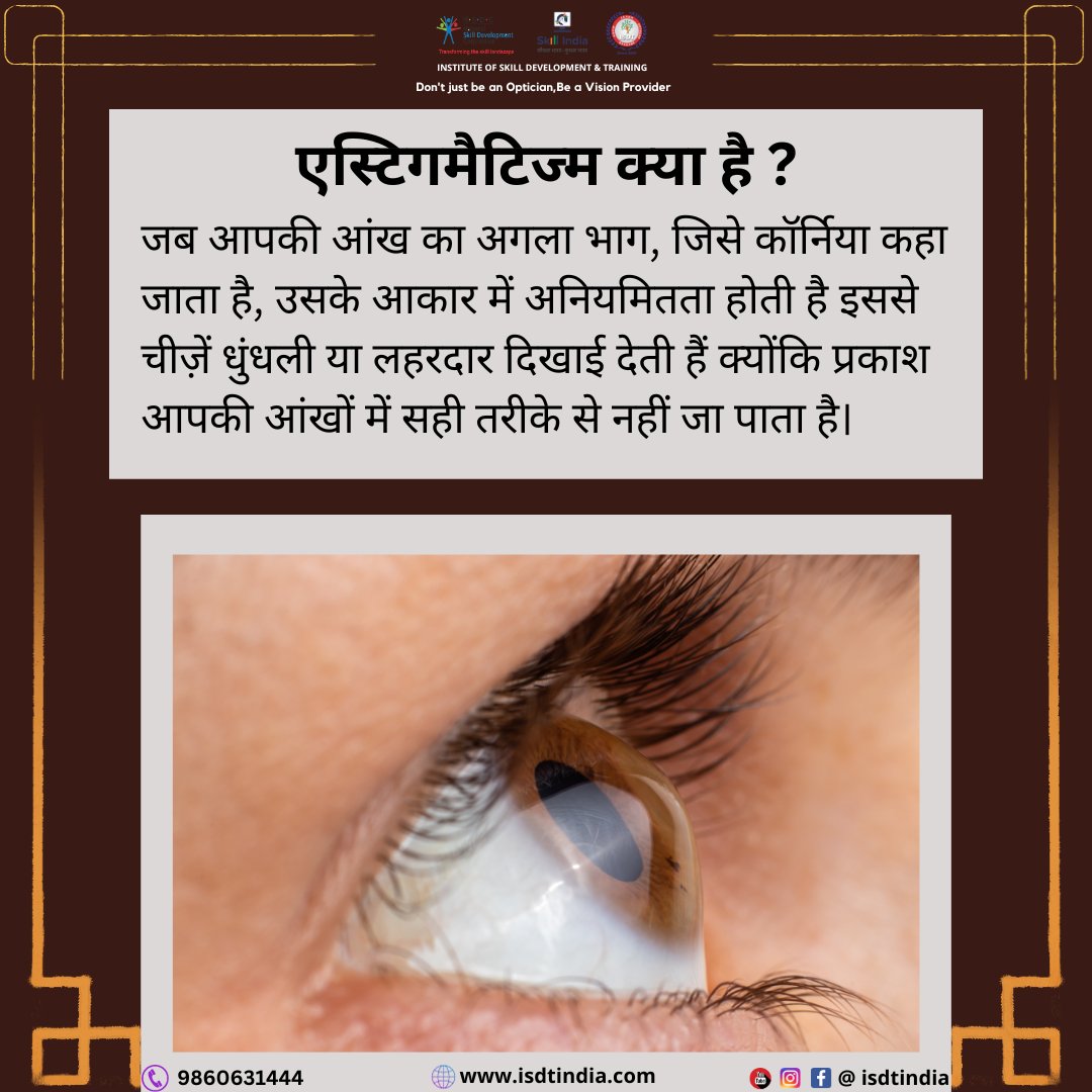 isdtindiacdo's tweet image. Curious about astigmatism? It's all about the shape of your eye. 👁️ Let's dive into what astigmatism is and how it can affect your vision. #Astigmatism #EyeHealth #EyeCondition #VisionHealth #Eyesight #EyeAnatomy #UnderstandingAstigmatism  #EyeCare #EyeFacts #AstigmatismAwareness