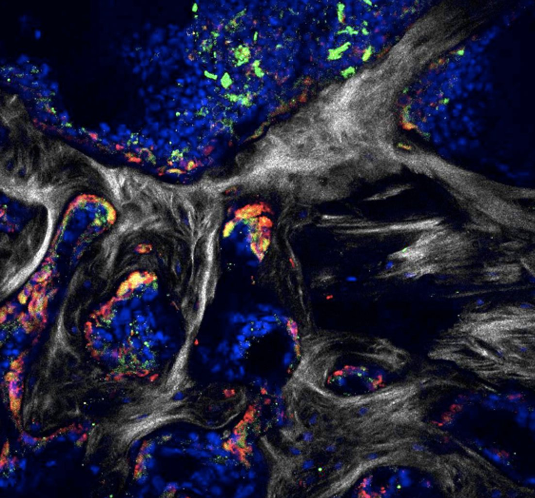 Postdoctoral Fellow - LEUCHT LAB - Skeletal Stem Cell Biology and Aging nature.com/naturecareers/… 
<a href="/nyugrossman/">NYU Grossman School of Medicine</a> <a href="/nyulangone/">NYU Langone Health</a> #ASBMR2023