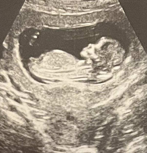 James K. Kim tweet media