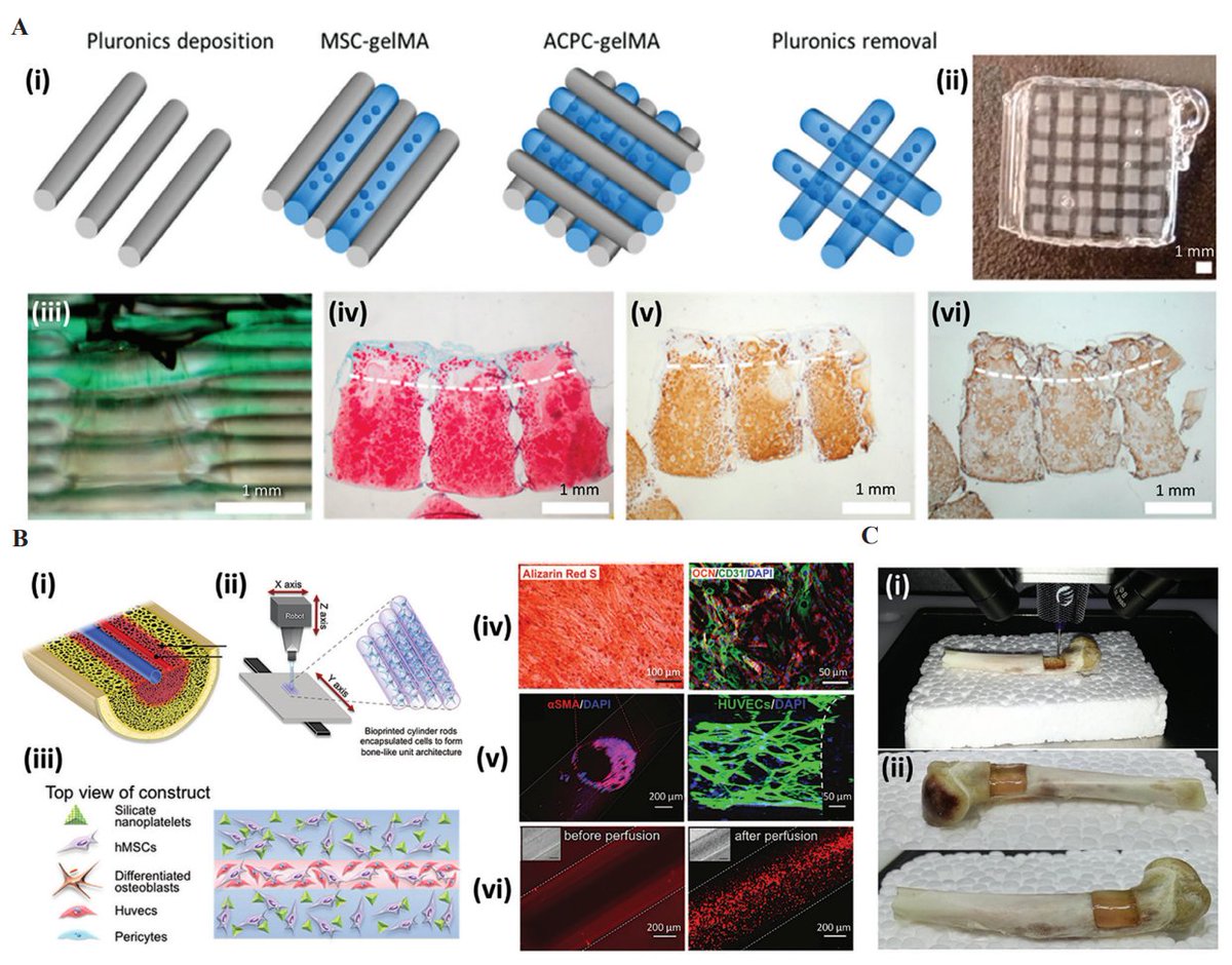 IJB_ASP's tweet photo. 🔥Highly cited paper "#Bioinks for 3D #Bioprinting: A #Scientometric Analysis of Two Decades of Progress"
👥By Mario Moisés Alvarez et al.
📖Read and download at: https://t.co/ew0EhIFdLM https://t.co/YH8YOeQIbP
