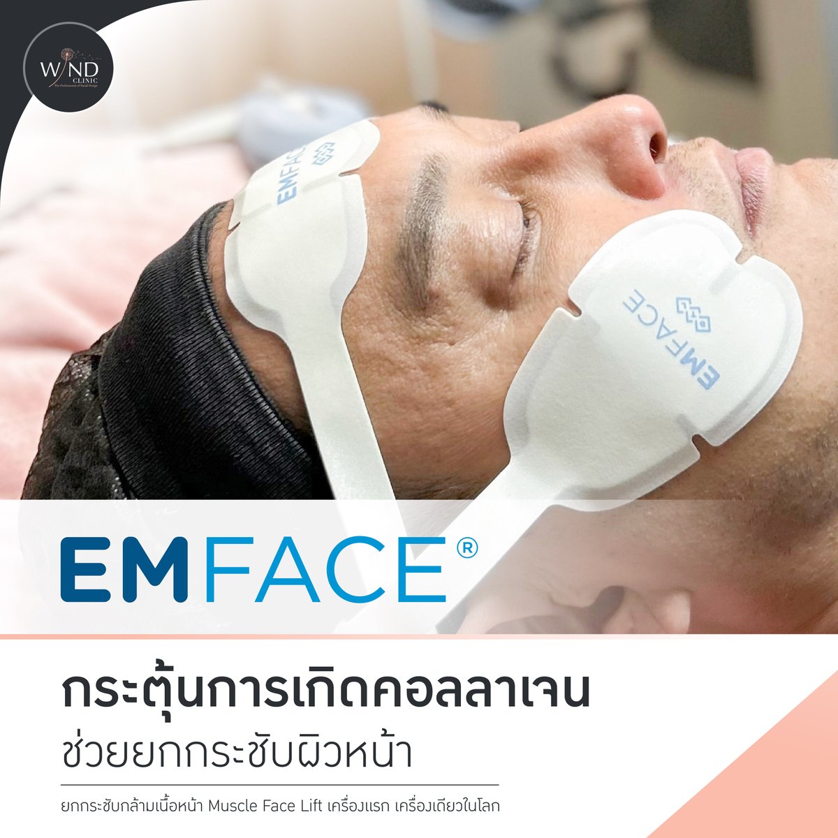 windclinic's tweet photo. แก้ปัญหาหย่อนคล้อย ร่องแก้มลึก มุมปากตก
กับคุณ #ก้องอายุน้อยร้อยล้าน
ยกกระชับใบหน้าลงลึกได้ถึงชั้นกล้ามเนื้อ
ด้วยคลื่นแม่เหล็กไฟฟ้าและกระตุ้นคอลลาเจนด้วยคลื่น RF
แค่นอนเฉยๆ20 นาที  หน้าก็ยกกระชับ #emface #btlaesthetics
#หมอบาส_นายแพทย์เฉลิมชัย_ศรีอัครพงศ์
#ปรับรูปหน้า https://t.co/05l8fjjJPq