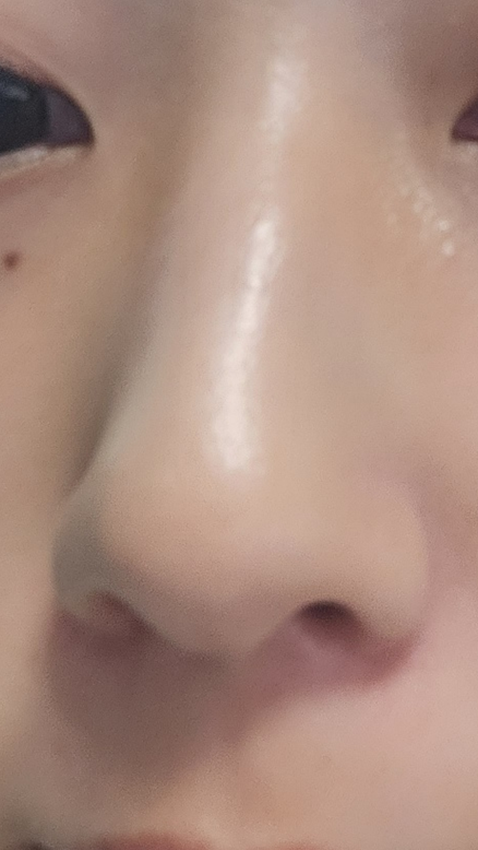 hitnrunwh's tweet photo. 다들 애기코하세여.... 코만 깨끗해져도 사람 첫인상부터 멀끔해보임 코에있는 모공 늘리면 돌이킬수없으니 한번 제거할 때 제대로 확실히 하시길 요즘들어 화장 젤 잘 먹는다;😵‍💫 https://t.co/amb360Yuxr