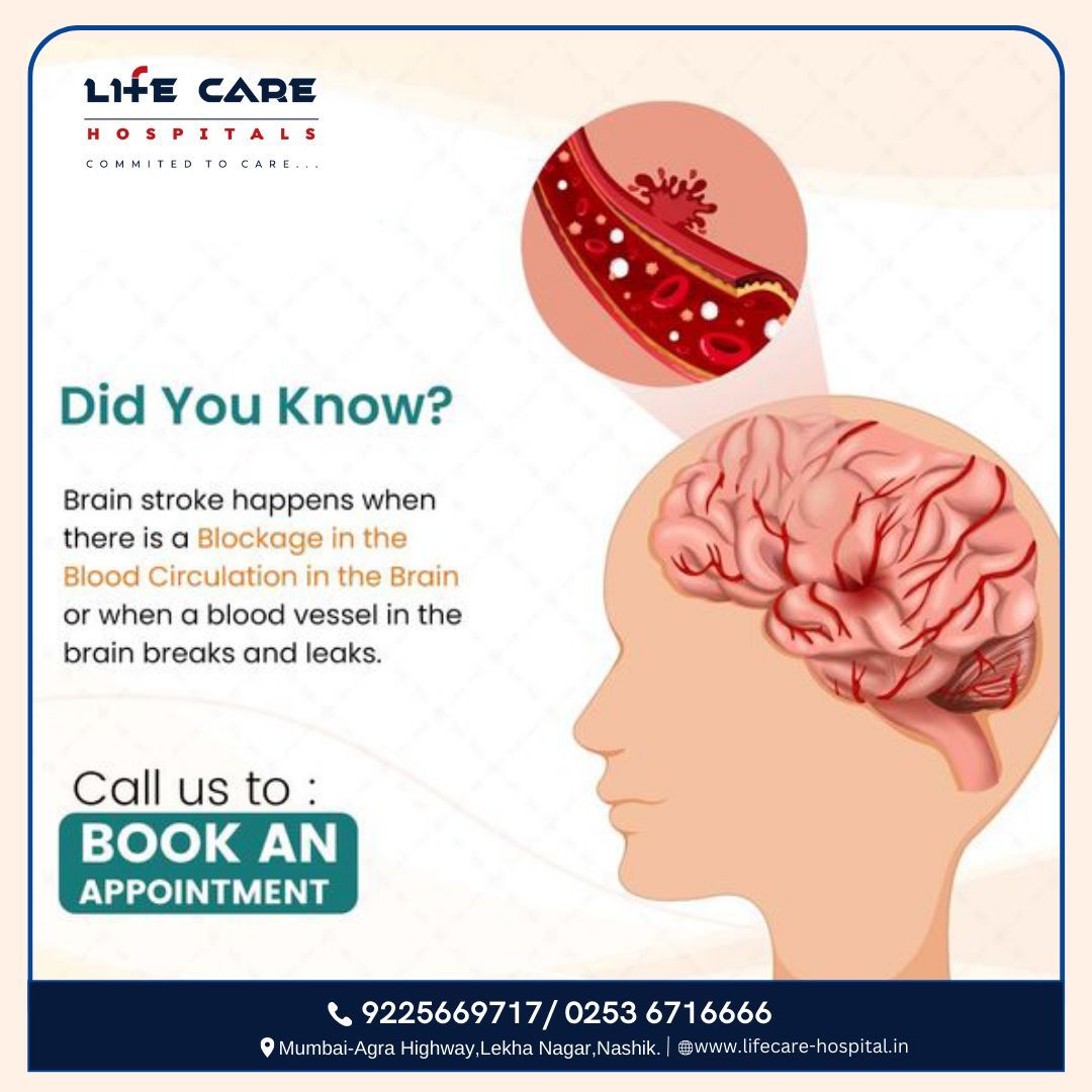 Did you Know?
Brain stroke happens when there is a Blockage in the Blood Circulation in the Brain or when a blood vessel in the brain breaks and leaks.

for more details contact us on : 9225669717

#BrainStroke #Nashik #LifeCareHospitals