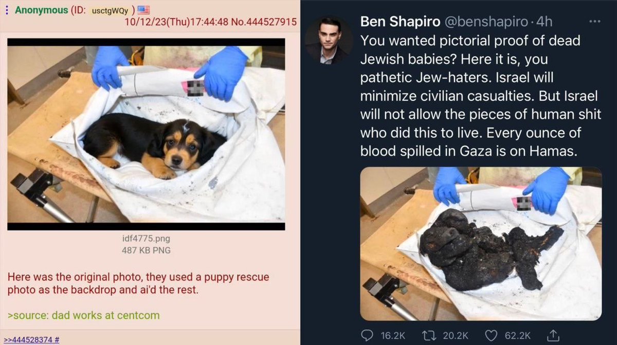 The original picture is actually from a dog in a veterinary hospital replaced and generated using Ai to show burnt child. Never trust anything they post.