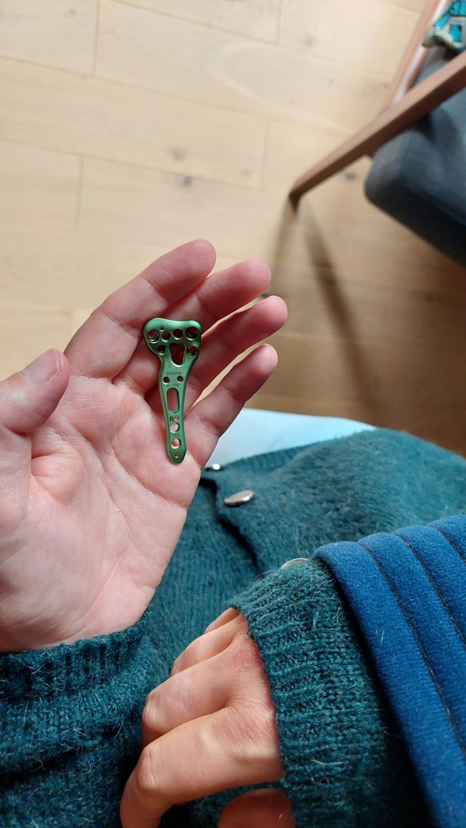 chamolko's tweet image. Hier à cette heure je rentrais au bloc opératoire. 6 mois jour pour jour après la première fois. Ma fracture du radius étant totalement consolidée il était temps d'effectuer le retrait du matériel. 
Je suis rentrée chez moi avec un petit souvenir aussi étrange que précieux.