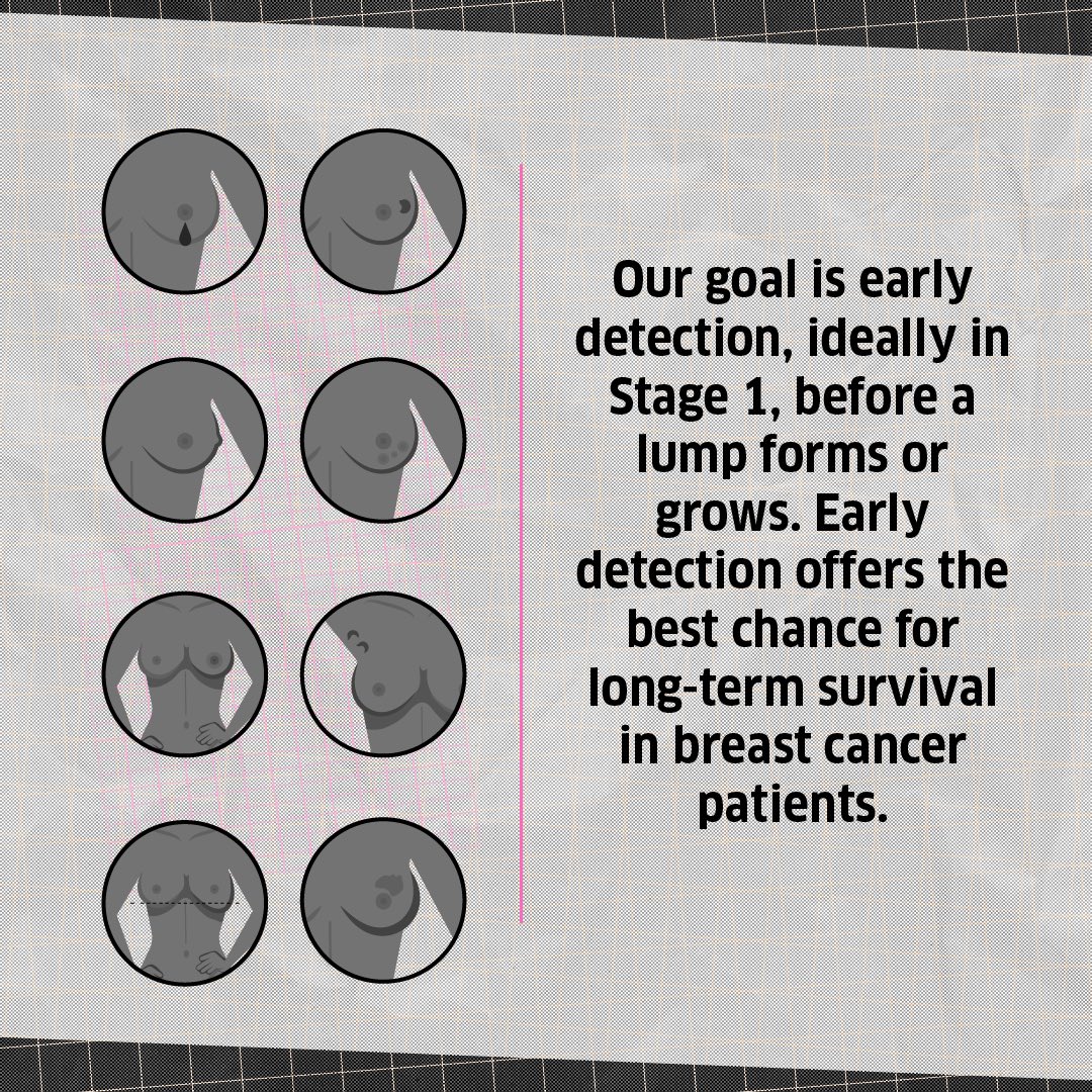 YOUWECAN's tweet photo. Early detection not only increases survival chances but also reduces the need for radical treatments. 

Breast conservation, a procedure that removes the cancerous lump while preserving the breast's appearance, has become the gold standard for early-stage breast cancer. https://t.co/fMS6APdo17