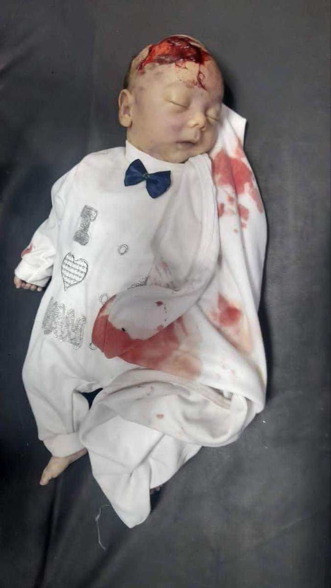 Ahmedalyusif's tweet photo. Urgent | General aljazeera in  #Gaza for Children's Island: Newborns were 
killed due to bombing on milk
#Israel is terrorist
  #Hamas https://t.co/FhIxoiR99K