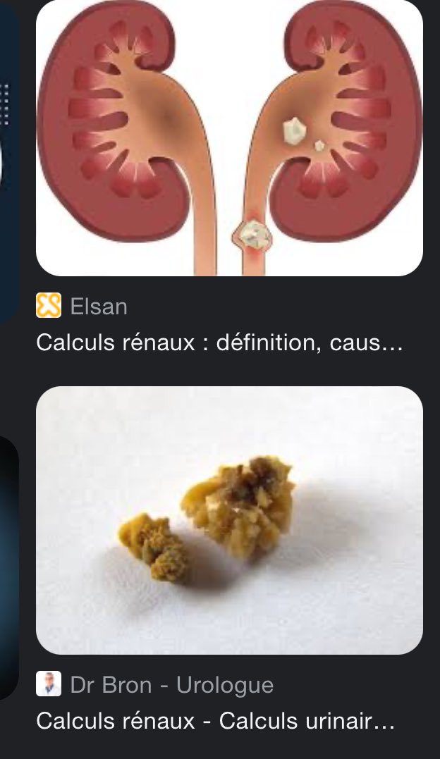 aam_mh's tweet photo. @D4rkJean Ça te passera l’envie de te poser la question https://t.co/LYuAnMPtvq