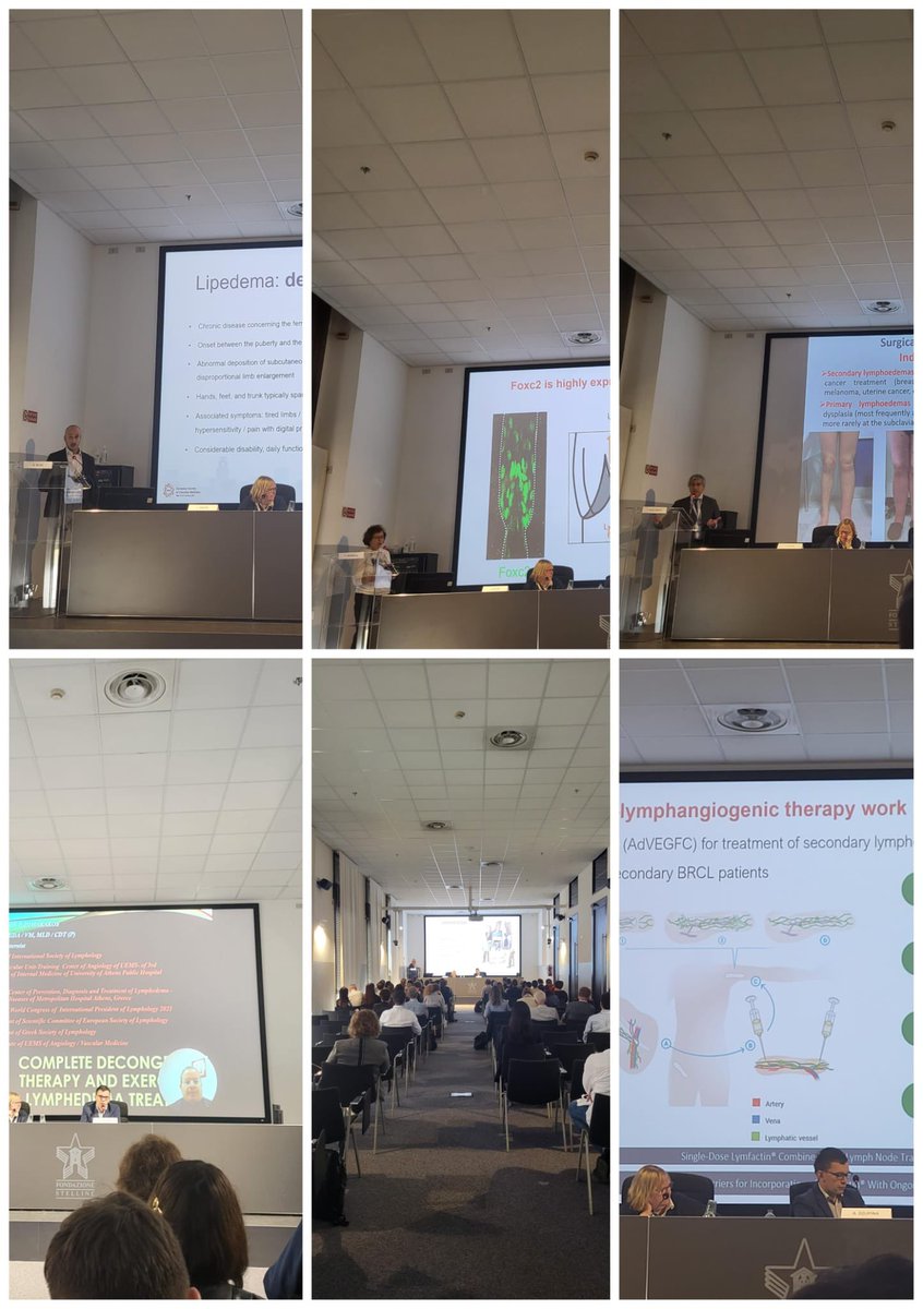 European Society of Vascular Medicine (@esvm_) on Twitter photo Great success of the <a href="/lymphedema/">Lymphe Dema</a> session at the #ESVM2023. Awareness on this still too often underdiagnosed disease is increasing
#VascularMedicine #congress <a href="/LuciaMazzolai/">Lucia Mazzolai</a> @isabelleQuere @francescoBoccardo @DzupinaA @tatianaPetrova <a href="/GiacomoBuso/">DocBuso</a> @OnoratoA @dimakakosE Great success of the <a href="/lymphedema/">Lymphe Dema</a> session at the #ESVM2023. Awareness on this still too often underdiagnosed disease is increasing
#VascularMedicine #congress <a href="/LuciaMazzolai/">Lucia Mazzolai</a> @isabelleQuere @francescoBoccardo @DzupinaA @tatianaPetrova <a href="/GiacomoBuso/">DocBuso</a> @OnoratoA @dimakakosE