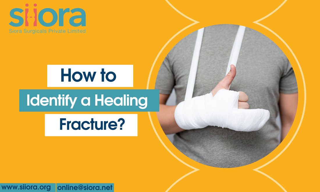 siorasurgicals's tweet image. Severe fractures often need surgery and this may also involve the use of a Locking Plate System or other trauma implants depending on the type and severity of the fracture.
siora-surgical.weebly.com/blog/how-to-id…
@siorasurgicals #fractures #surgery #LockingPlateSystem #trauma #implants #pain