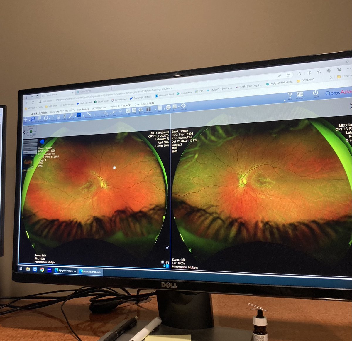 christ_hype's tweet photo. Look inside my pair (of eyeballs) https://t.co/bKpe7wuyoV