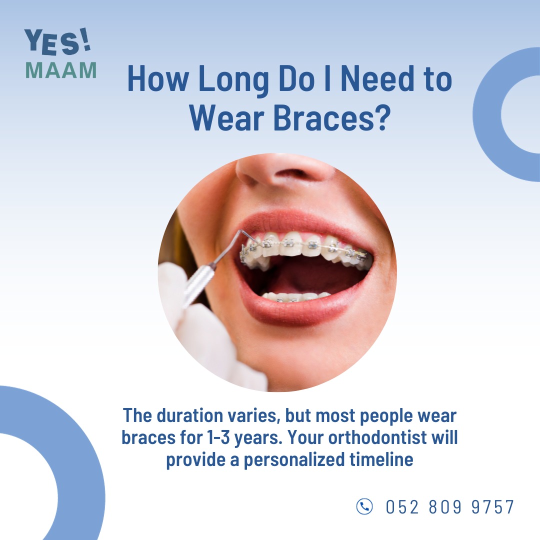 YesmaamOfficial's tweet photo. ๐ฆท Brace Yourself: For a beautiful smile! ๐ฆท
You're not alone! Here are some commonly asked questions about braces to help you on your journey to straighter, healthier smile. ๐
๐ How to contact Us ๐
๐ฒ Mobile Number: 054-299-8581
โ๏ธ Landline: 043446993
#BracesFAQ #Smile https://t.co/InYivAGN6l