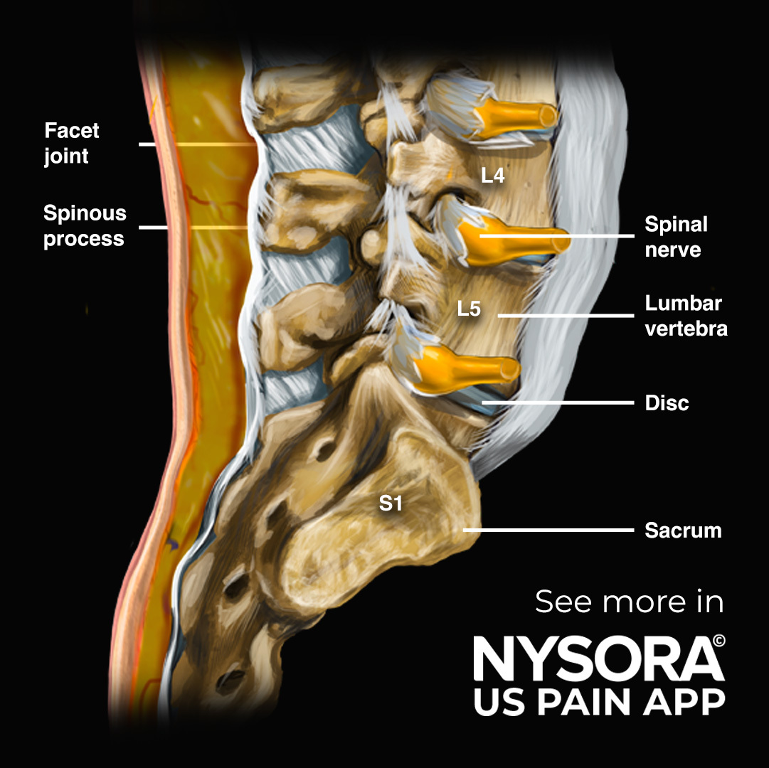 NYSORA's tweet image. 15 Brand New Illustrations have been added to NYSORA&apos;s US Pain App! 🎨

Experience it first-hand and test drive for free: nysora.com/nysora-us-app

#NYSORA #USPainApp #UpdateAlert #MedicalIllustrations