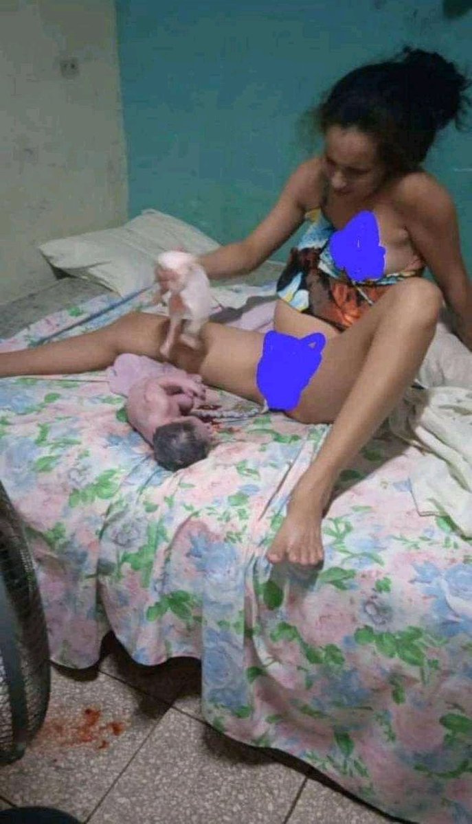 #CUBA #FALSAPOTENCIAMEDICA
MUJER DA A LUZ EN CASÁ PORQUÉ EN LOS HOSPITALES CUBANOS NO HAY  CAMAS PARA SER INGRESADA  .
#NUESTROPUEBLOSUFREPORCULPADELADICTADURA