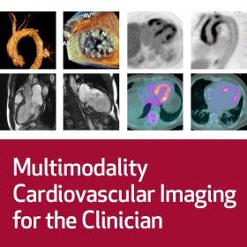 Twitter: 12th Annual Multimodality Cardiovascular Imaging for the Clinician taking place October 20-22 at (either @HM OR #HoustonMethodist). For more info and to register, please visit tinyurl.com/MMI-23 #cardiotwitter @williamzoghbi @allanlumbsden @almallahmo @slittlemd