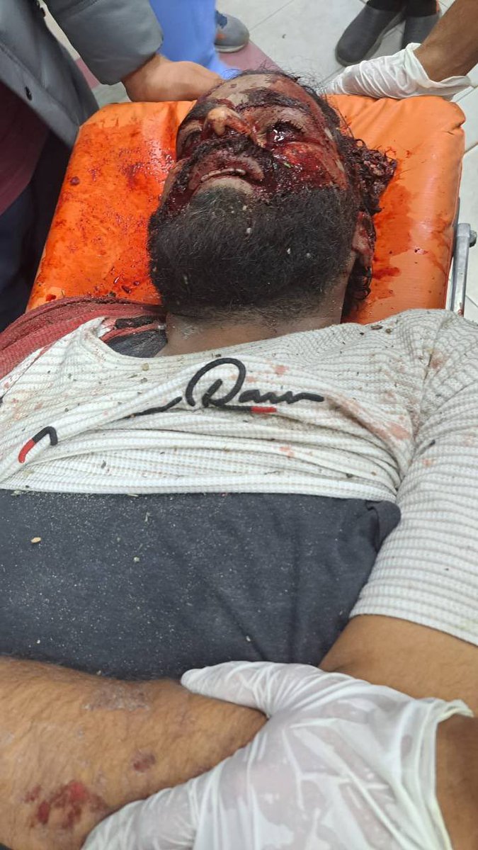 ZaidAlsalman6's tweet photo. لا حول ولا قوّة إلّا بالله دايمًا بشوف فيديوهاته على التويتر وبحكي الله يعطيه العافية ويحميه على نقل الأخبار من غزّة .. حسبنا الله ونعم الوكيل على هيك كيان صهيوني وحشي. 💔🇵🇸
الناشط علي السمّان استشهد 🇵🇸✌🏻 https://t.co/rnBvuhtR3N