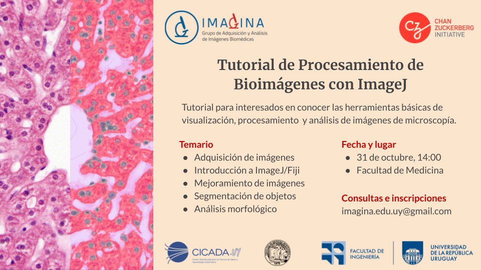 federico lecumberry (@flecumberry) on Twitter photo 🎉🛎️Volvemos con el Tutorial de Procesamiento de Bioimágenes con ImageJ el *martes 31/Oct* a las 14 en FMed. 🧬🦠🧪🔬💻
"De 0 a segmentar y analizar morfología en 4 horas." 😉
✍️Inscripciones forms.gle/a5AQeiDQxtM5rR…
<a href="/ImaginaUdelar/">IMAGINA UdelaR</a> <a href="/CicadaUy/">cicada.uy</a> <a href="/IPMontevideo/">Institut Pasteur Montevideo</a> <a href="/IIBCE/">Instituto Clemente Estable</a> <a href="/FcienUdelar/">Facultad de Ciencias</a> 🎉🛎️Volvemos con el Tutorial de Procesamiento de Bioimágenes con ImageJ el *martes 31/Oct* a las 14 en FMed. 🧬🦠🧪🔬💻
"De 0 a segmentar y analizar morfología en 4 horas." 😉
✍️Inscripciones forms.gle/a5AQeiDQxtM5rR…
<a href="/ImaginaUdelar/">IMAGINA UdelaR</a> <a href="/CicadaUy/">cicada.uy</a> <a href="/IPMontevideo/">Institut Pasteur Montevideo</a> <a href="/IIBCE/">Instituto Clemente Estable</a> <a href="/FcienUdelar/">Facultad de Ciencias</a>