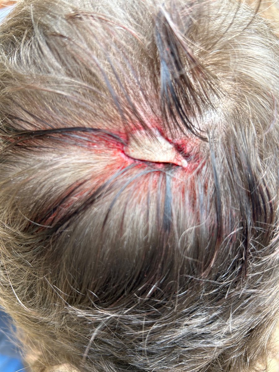 PurcellforGA's tweet photo. I was terrorized by a tin shed on this national day of terror and I survived! https://t.co/9V1pdKUq1b