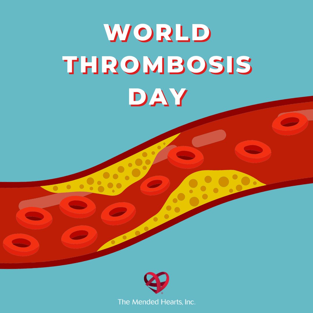 Today is World Thrombosis Day! A #Thrombosis is defined as the formation of a blood clot (partial or complete blockage) within blood vessels. Blood clots can be life-threatening; join us in raising awareness of the dangers of blood clots. Learn more: mendedhearts.org/peripheral-art…
