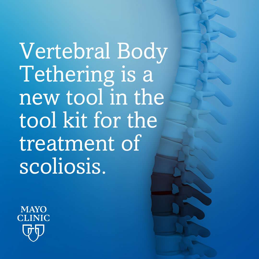 PedsOrthoGirl's tweet photo. With a breakthrough approach that focuses on preserving motion, Dr. Larson is empowering her patients to embrace a future of mobility and vitality.

Learn about this advanced treatment: https://t.co/2EE2ZyHH1n

#InnovationStartsAtMayo #MayoClinicMN #Scoliosis https://t.co/CvaNeXwwce