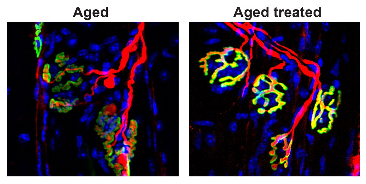 StemCellsPortal's tweet photo. Restoring nerve-muscle connections boosts strength of aging mice, Stanford Medicine study finds https://t.co/tuiVlB8bU3 https://t.co/TQfDHhqIgL