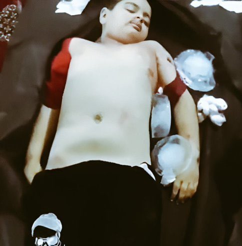 حالا که بحث «کودک کُشی» شده خواستم یادآوری کنم؛
همین یک سال پیش مادری برای اینکه جسد کودک ۹ساله‌اش را ندزدند از همسایه‌ها یخ قرض گرفت دور جنازه‌ جگرگوشه‌اش گذاشت تا بتواند صبح او را دفن کند.

#کیان_پیرفلک